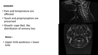 approach to radiology of spinal cord.pptx