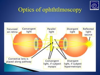 Optics of ophthtlmoscopy
 