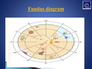 Fundus diagram
 