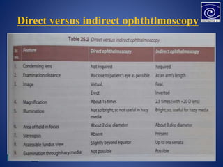 Direct versus indirect ophthtlmoscopy
 