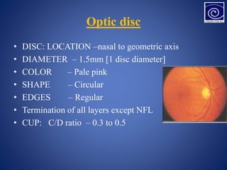 Optic disc
• DISC: LOCATION –nasal to geometric axis
• DIAMETER – 1.5mm [1 disc diameter]
• COLOR – Pale pink
• SHAPE – Circular
• EDGES – Regular
• Termination of all layers except NFL
• CUP: C/D ratio – 0.3 to 0.5
 