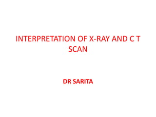 INTERPRETATION OF X-RAY AND C T 
SCAN 
DR SARITA 
 