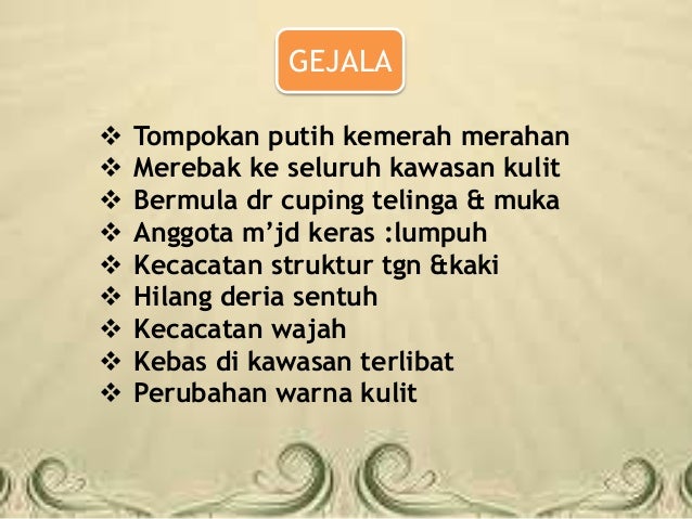 PENYAKIT KUSTA DAN PERKEMBANGANNYA DI MALAYSIA PENYAKIT KUSTA DAN PERKEMBANGANNYA DI MALAYSIA