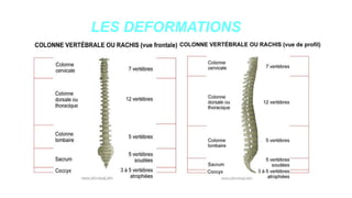 LES DEFORMATIONS
www.is p
i
t
s.
n
et
 