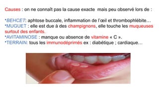 Causes : on ne connaît pas la cause exacte mais peu observé lors de :
•BEHCET: aphtose buccale, inflammation de l’œil et thrombophlébite…
•MUGUET : elle est due à des champignons, elle touche les muqueuses
surtout des enfants.
•AVITAMINOSE : manque ou absence de vitamine « C ».
•TERRAIN: tous les immunodéprimés ex : diabétique ; cardiaque…
 