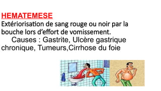 HEMATEMESE
Extériorisation de sang rouge ou noir par la
bouche lors d’effort de vomissement.
Causes : Gastrite, Ulcère gastrique
chronique, Tumeurs,Cirrhose du foie
 