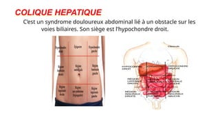 COLIQUE HEPATIQUE :
C’est un syndrome douloureux abdominal lié à un obstacle sur les
voies biliaires. Son siège est l’hypochondre droit.
 