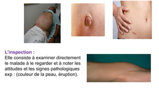 L’inspection :
Elle consiste à examiner directement
le malade à le regarder et à noter les
attitudes et les signes pathologiques
exp : (couleur de la peau, éruption).
 