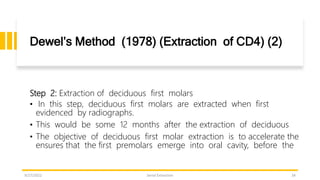 Serial extraction.pptx