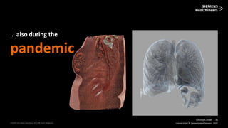 11
Frei verwendbar © Siemens Healthineers, 2021
Unrestricted © Siemens Healthineers, 2021
11
COVID-19 data courtesy of CHR East Belgium.
Christoph Zindel
… also during the
pandemic
 