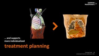 15
Frei verwendbar © Siemens Healthineers, 2021
Unrestricted © Siemens Healthineers, 2021
15
Christoph Zindel
… and supports
more individualized
treatment planning
 