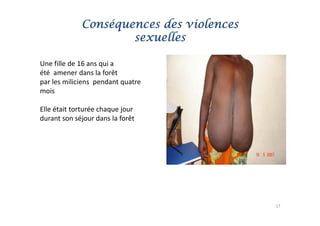 Conséquences des violences
                     sexuelles

Une fille de 16 ans qui a
U fill d 16            i
été  amener dans la forêt
par les miliciens  pendant quatre
mois

Elle était torturée chaque jour
durant son séjour dans la forêt




                                          17
 
