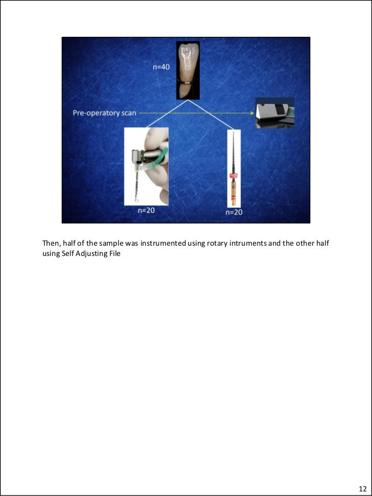 Flatoval root canal preparation with SelfAdjusting File instrument…