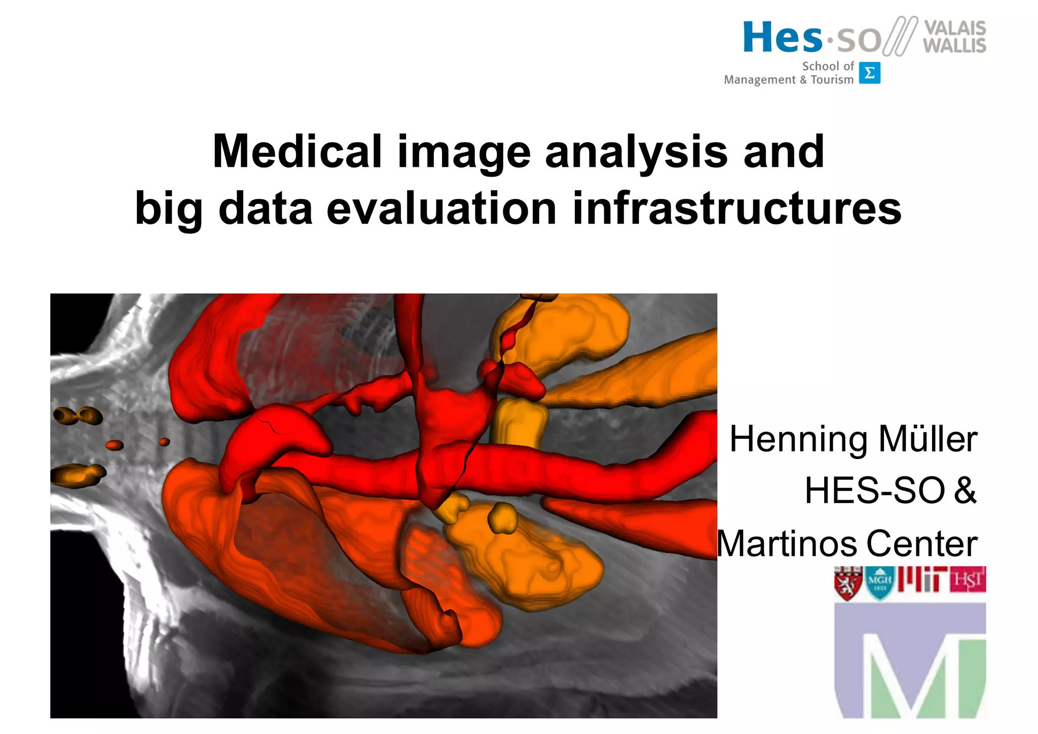 Medical image analysis and
big data evaluation infrastructures
Henning Müller
HES-SO &
Martinos Center
 