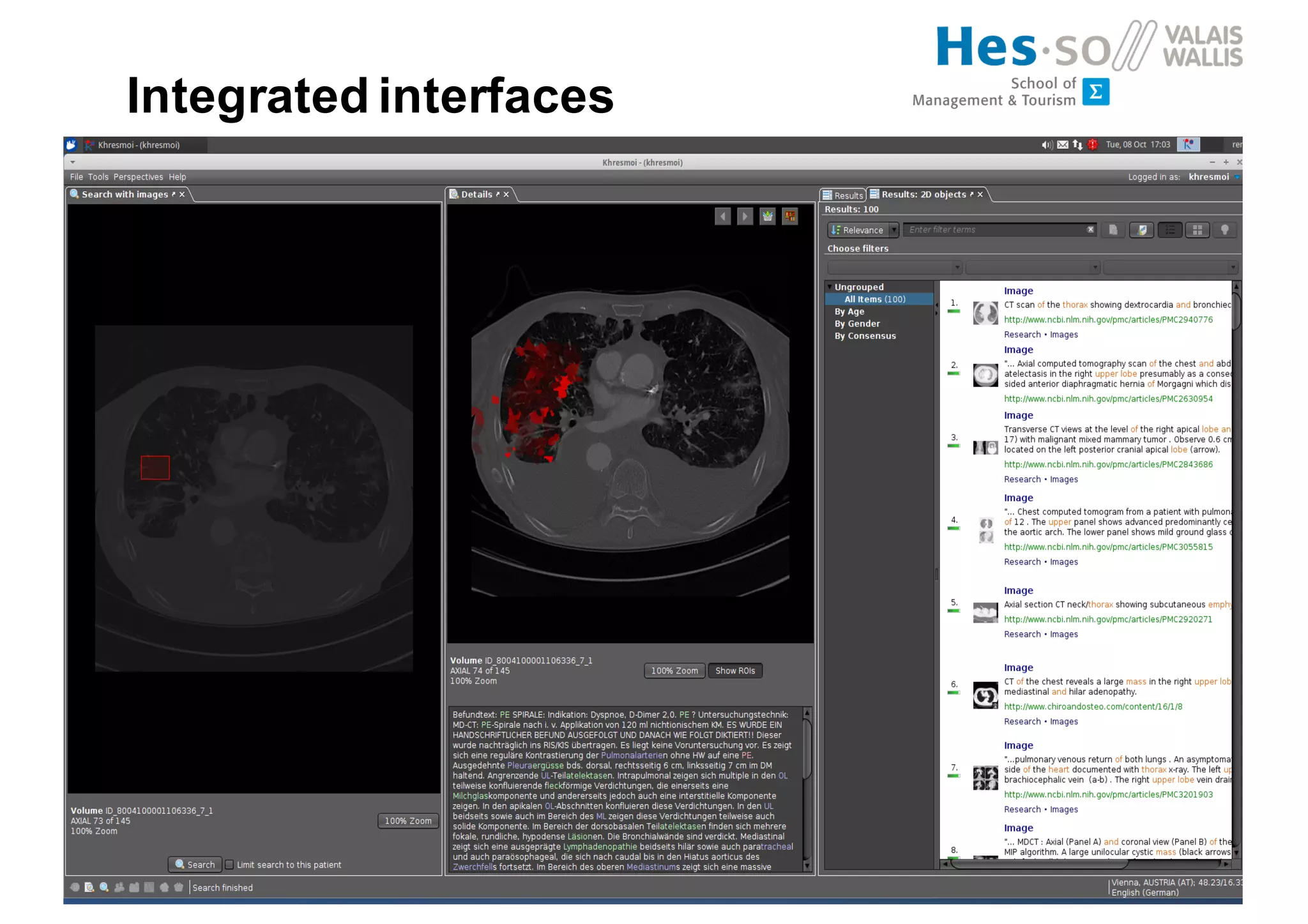 Integrated interfaces
 