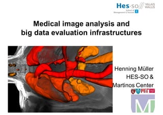 Medical image analysis and
big data evaluation infrastructures
Henning Müller
HES-SO &
Martinos Center
 