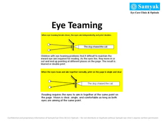 Eye Teaming
Confidential and proprietary information of Samyak Eye Clinic &1111 Opticals – Do not distribute or duplicate without Samyak eye clinic’s express written permission
 