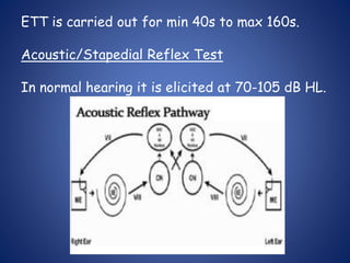 ETT is carried out for min 40s to max 160s.
Acoustic/Stapedial Reflex Test
In normal hearing it is elicited at 70-105 dB HL.
 