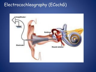 Electrocochleography (ECochG)
 