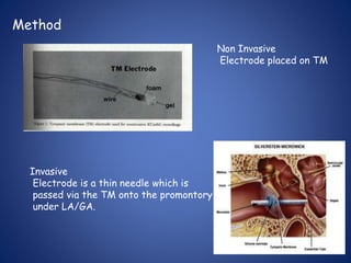 Method
Non Invasive
Electrode placed on TM
Invasive
Electrode is a thin needle which is
passed via the TM onto the promontory
under LA/GA.
 