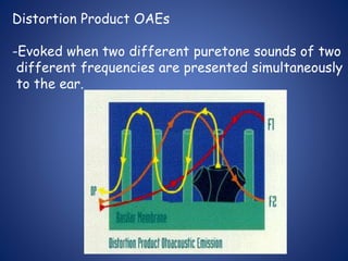 Distortion Product OAEs
-Evoked when two different puretone sounds of two
different frequencies are presented simultaneously
to the ear.
 