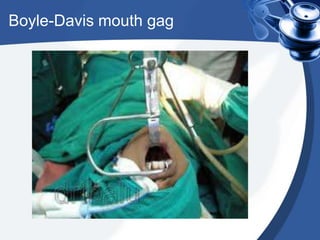 Boyle-Davis mouth gag
 