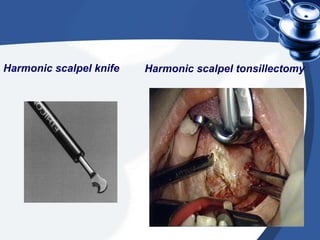 Harmonic scalpel knife   Harmonic scalpel tonsillectomy
 