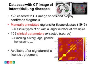 Database with CT image of
interstitial lung diseases
• 128 cases with CT image series and biopsy
confirmed diagnosis
• Manually annotated regions for tissue classes (1946)
– 6 tissue types of 13 with a larger number of examples
• 159 clinical parameters extracted (sparse)
– Smoking history, age, gender,
hematocrit, …
• Availableafter signature of a
license agreement
 
