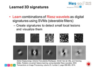 Learned 3D signatures
• Learn combinations of Riesz wavelets as digital
signatures using SVMs (steerable filters)
– Create signatures to detect small local lesions
and visualize them
Adrien Depeursinge, Antonio Foncubierta–Rodriguez, Dimitri Van de Ville, and Henning
Müller, Rotation–covariant feature learning using steerable Riesz wavelets, IEEE
Transactions on Image Processing, volume 23, number 2, page 898-908, 2014.
 