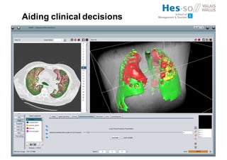 Aiding clinical decisions
 