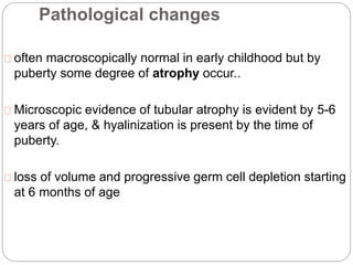 Pathological changes
often macroscopically normal in early childhood but by
puberty some degree of atrophy occur..
Microscopic evidence of tubular atrophy is evident by 5-6
years of age, & hyalinization is present by the time of
puberty.
loss of volume and progressive germ cell depletion starting
at 6 months of age
 