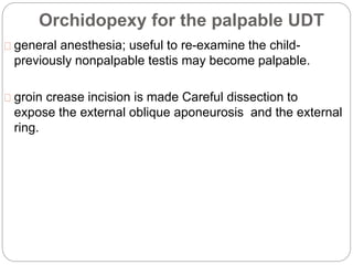Orchidopexy for the palpable UDT
general anesthesia; useful to re-examine the child-
previously nonpalpable testis may become palpable.
groin crease incision is made Careful dissection to
expose the external oblique aponeurosis and the external
ring.
 