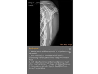 Presentation UPPER LIMB.pptx it is about x ray positioning of upper ...