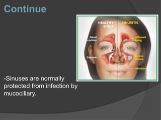 Continue
-Sinuses are normally
protected from infection by
mucociliary.
 
