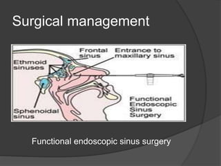 Surgical management
Functional endoscopic sinus surgery
 