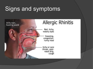 Signs and symptoms
 