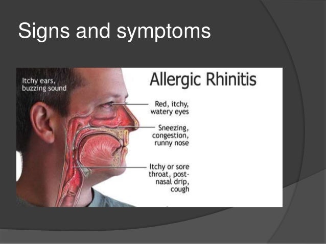 Upper Respiratory Infection Vs Allergies Human Anatomy