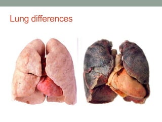 Lung differences
 