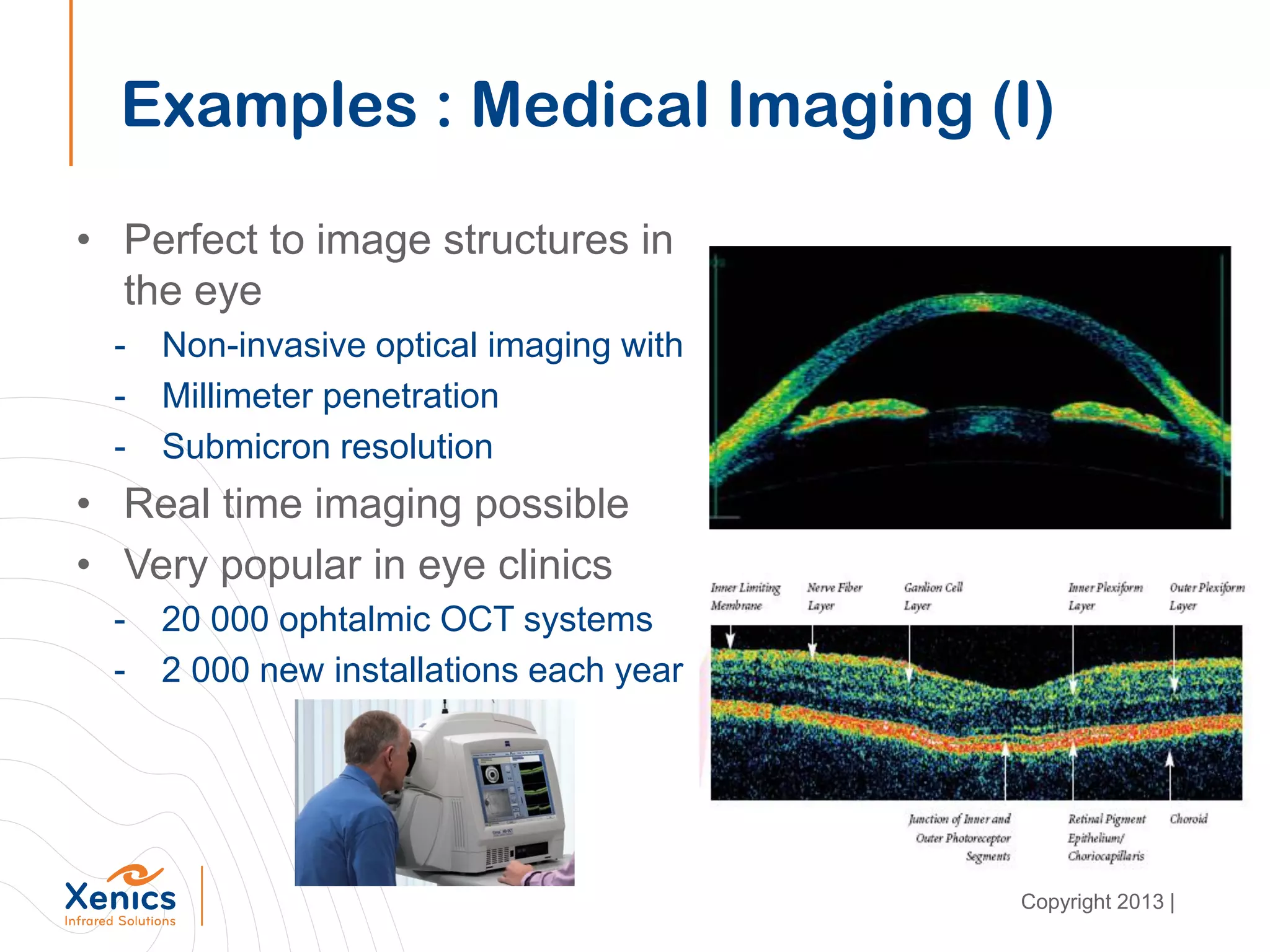 Examples : Medical Imaging (I)
• Perfect to image structures in
the eye
- Non-invasive optical imaging with
- Millimeter penetration
- Submicron resolution
• Real time imaging possible
• Very popular in eye clinics
- 20 000 ophtalmic OCT systems
- 2 000 new installations each year
Copyright 2013 |
 