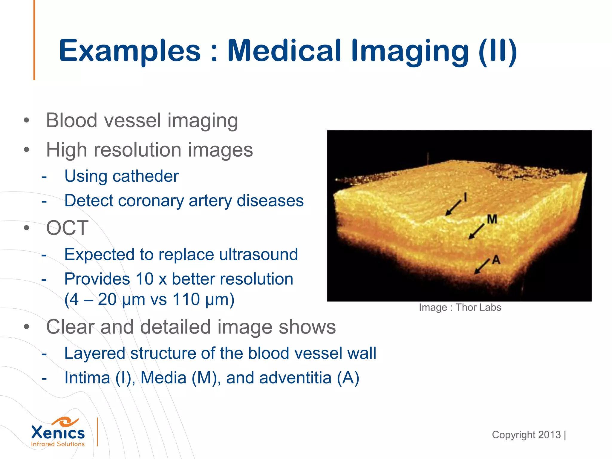 • Blood vessel imaging
• High resolution images
- Using catheder
- Detect coronary artery diseases
• OCT
- Expected to replace ultrasound
- Provides 10 x better resolution
(4 – 20 μm vs 110 μm)
• Clear and detailed image shows
- Layered structure of the blood vessel wall
- Intima (I), Media (M), and adventitia (A)
Examples : Medical Imaging (II)
Image : Thor Labs
Copyright 2013 |
 