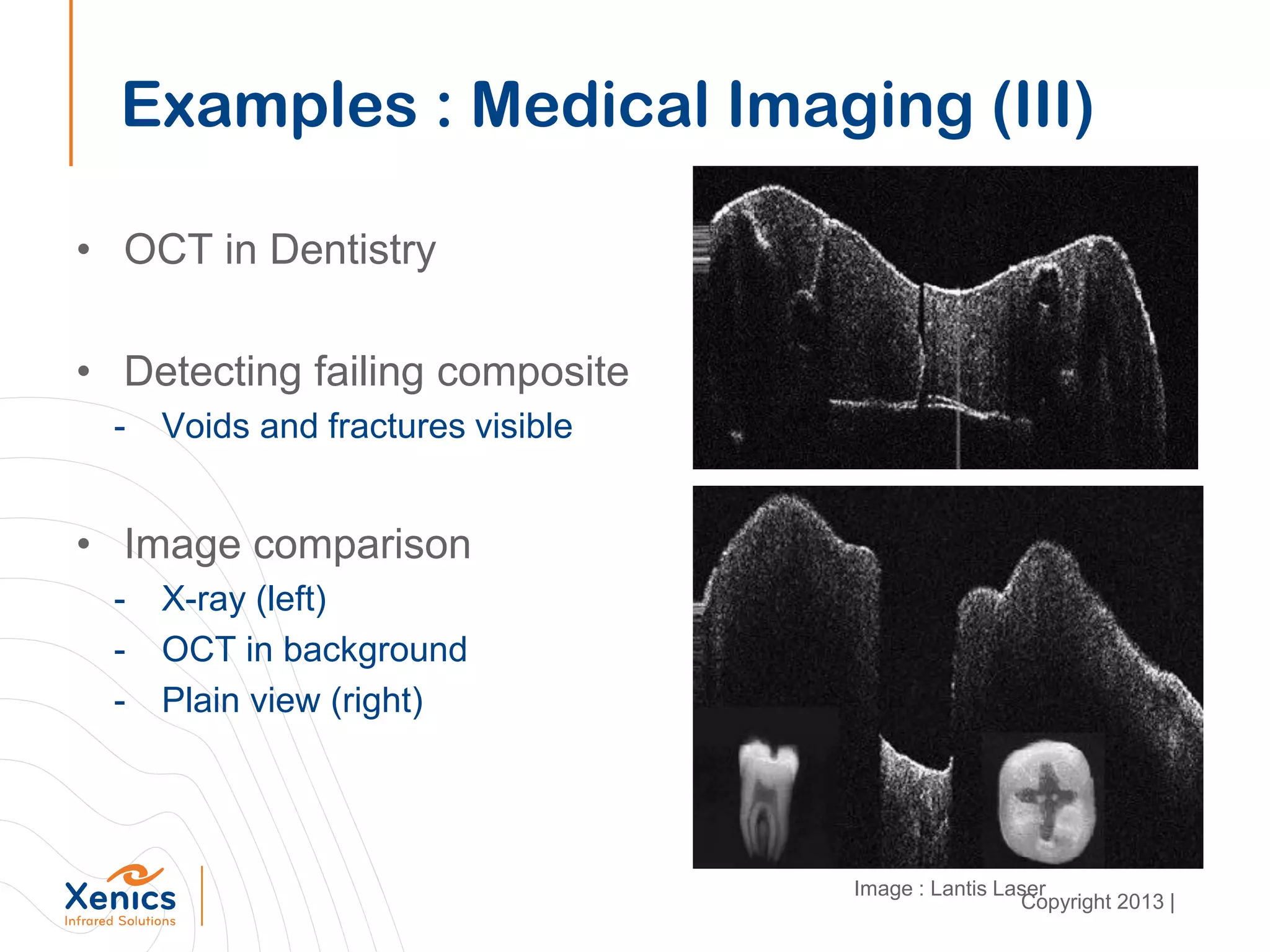 • OCT in Dentistry
• Detecting failing composite
- Voids and fractures visible
• Image comparison
- X-ray (left)
- OCT in background
- Plain view (right)
Examples : Medical Imaging (III)
Image : Lantis Laser
Copyright 2013 |
 