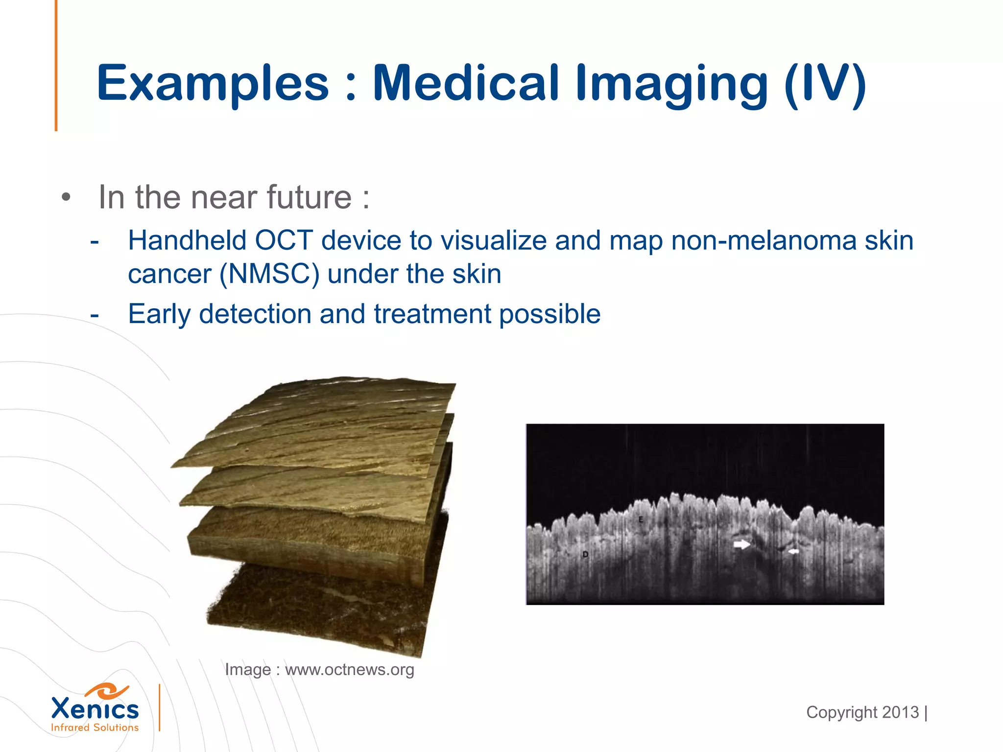 • In the near future :
- Handheld OCT device to visualize and map non-melanoma skin
cancer (NMSC) under the skin
- Early detection and treatment possible
Examples : Medical Imaging (IV)
Image : www.octnews.org
Copyright 2013 |
 