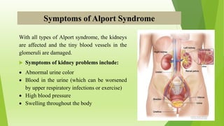 Symptoms of Alport Syndrome
With all types of Alport syndrome, the kidneys
are affected and the tiny blood vessels in the
glomeruli are damaged.
 Symptoms of kidney problems include:
 Abnormal urine color
 Blood in the urine (which can be worsened
by upper respiratory infections or exercise)
 High blood pressure
 Swelling throughout the body
 