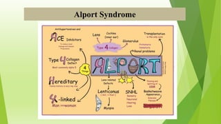 Alport Syndrome
 