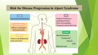 Risk for Disease Progression in Alport Syndrome
 