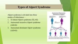 Types of Alport Syndrome
Alport syndrome is divided into three
modes of inheritance –
1. X-linked Alport syndrome (XLAS)
2. Autosomal recessive Alport syndrome
(ARAS)
3. Autosomal dominant Alport syndrome
(ADAS)
 