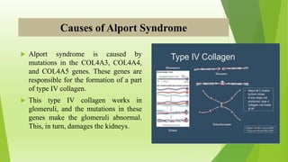 Causes of Alport Syndrome
 Alport syndrome is caused by
mutations in the COL4A3, COL4A4,
and COL4A5 genes. These genes are
responsible for the formation of a part
of type IV collagen.
 This type IV collagen works in
glomeruli, and the mutations in these
genes make the glomeruli abnormal.
This, in turn, damages the kidneys.
 