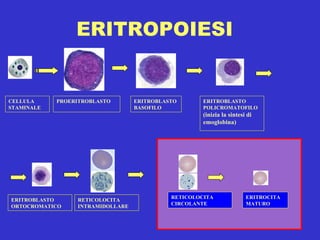 ERITROPOIESI CELLULA STAMINALE PROERITROBLASTO ERITROBLASTO BASOFILO ERITROBLASTO POLICROMATOFILO  (inizia la sintesi di emoglobina) ERITROBLASTO ORTOCROMATICO RETICOLOCITA INTRAMIDOLLARE RETICOLOCITA CIRCOLANTE ERITROCITA MATURO 