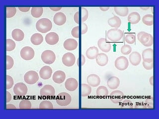 EMAZIE NORMALI MICROCITICHE-IPOCOMICHE 