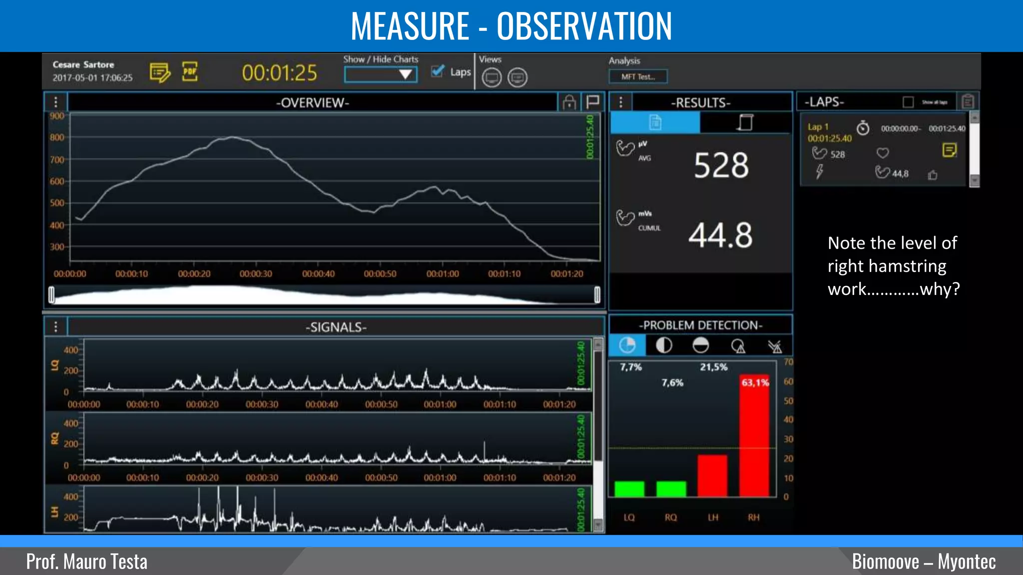 MEASURE - OBSERVATION
Prof. Mauro Testa Biomoove – Myontec
Note the level of
right hamstring
work…………why?
 